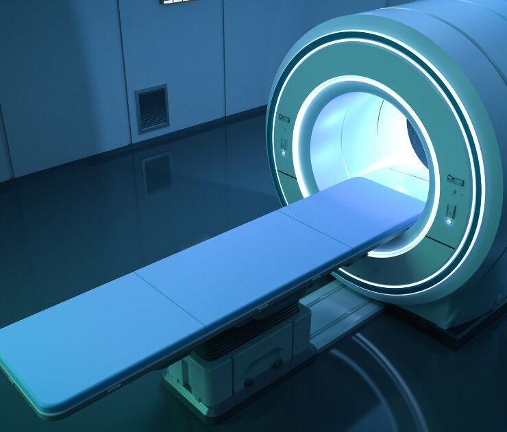 Prenuvo Scans for Employees